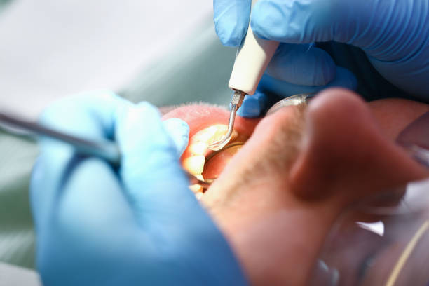 Best Same-Day Emergency Dentist in Pendleton, IN