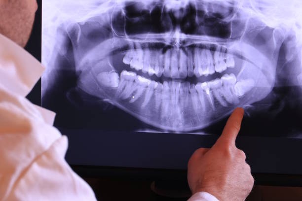 Best Emergency Dental Surgery in Pendleton, IN