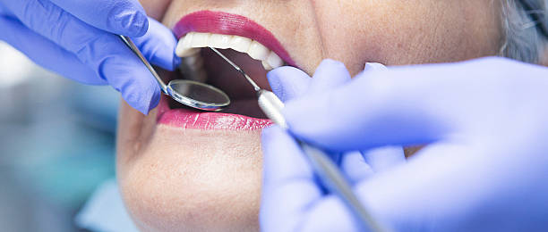 Best Emergency Dental Surgery in Pendleton, IN